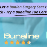 Bunion-Surgery-Scar