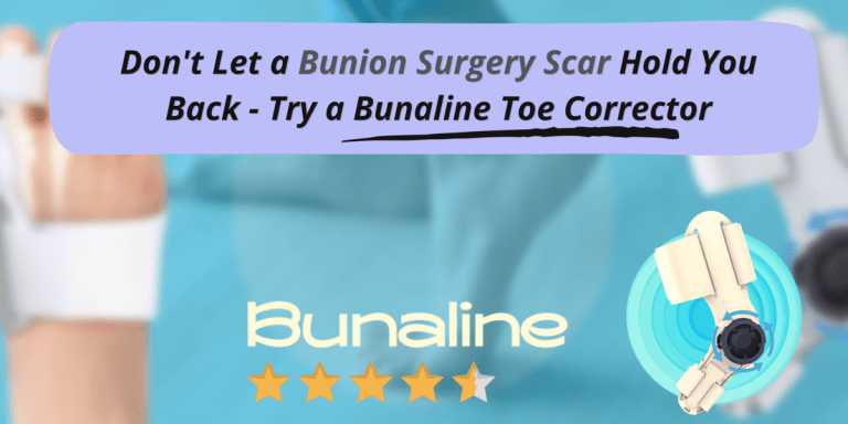 Bunion-Surgery-Scar