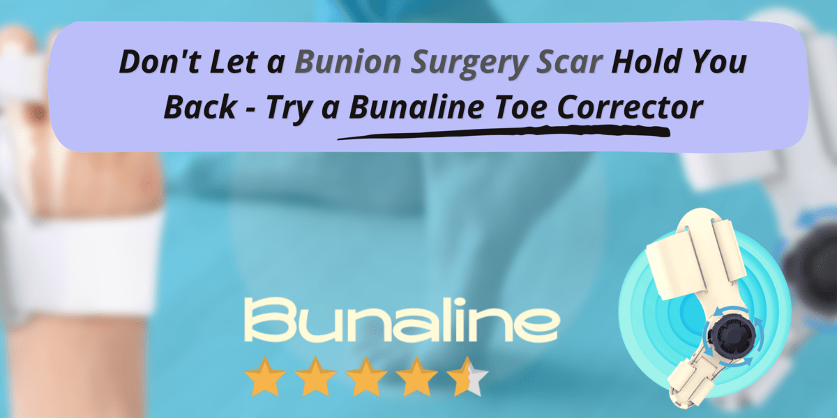 Bunion-Surgery-Scar